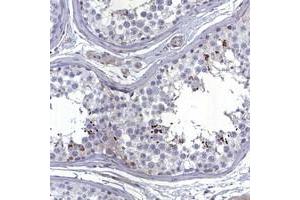 Immunohistochemical staining of human testis with CATSPER4 polyclonal antibody  shows strong cytoplasmic positivity in spermatids at 1:200-1:500 dilution. (CATSPER4 antibody)