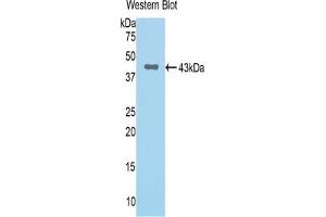 Western blot analysis of the recombinant protein. (Complement Factor B antibody  (AA 34-159))