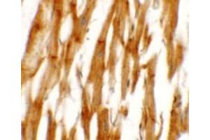 Immunohistochemistry of NCLN in human heart tissue with NCLN antibody at 2. (Nicalin antibody  (C-Term))