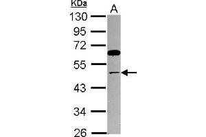 Western Blotting (WB) image for anti-Thyroid Hormone Receptor Interactor 13 (TRIP13) (AA 32-315) antibody (ABIN1501509) (TRIP13 antibody  (AA 32-315))