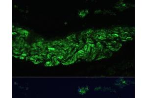 Immunofluorescence analysis of Rat lung using ALOX12 Polyclonal Antibody at dilution of 1:100 (40x lens). (ALOX12 antibody)