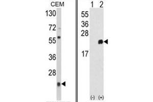 (LEFT) Western blot analysis of PRDX1 Antibody (Center) in CEM cell line lysates (35ug/lane). (Peroxiredoxin 1 antibody  (Middle Region))