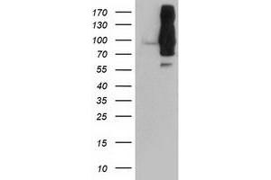 HEK293T cells were transfected with the pCMV6-ENTRY control (Left lane) or pCMV6-ENTRY DPP9 (Right lane) cDNA for 48 hrs and lysed. (DPP9 antibody)