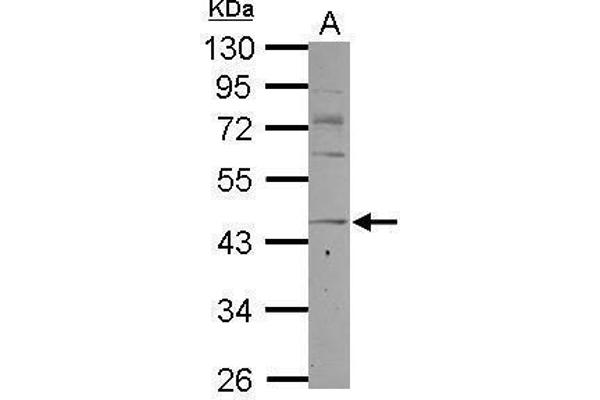CCR8 Antikörper  (C-Term)