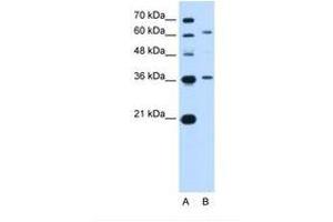 Image no. 1 for anti-Zinc Finger and SCAN Domain Containing 12 (ZSCAN12) (AA 142-191) antibody (ABIN341328) (ZSCAN12 antibody  (AA 142-191))