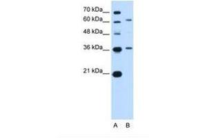 ZSCAN12 antibody  (AA 142-191)