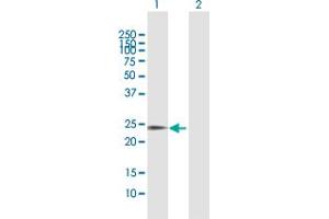 Western Blot analysis of SOHLH2 expression in transfected 293T cell line by SOHLH2 MaxPab polyclonal antibody. (SOHLH2 antibody  (AA 1-225))