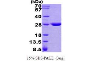 SDS-PAGE (SDS) image for Glutathione Transferase zeta 1 (Maleylacetoacetate Isomerase) (GSTZ1) (AA 1-216) protein (His tag) (ABIN666952) (GSTZ1 Protein (AA 1-216) (His tag))