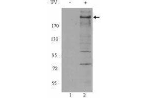 Western Blotting (WB) image for anti-Ataxia Telangiectasia Mutated (ATM) (phosphorylated) antibody (ABIN2666314) (ATM antibody  (phosphorylated))
