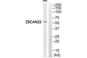 Western blot analysis of extracts from K562 cells, using ZSCAN22 antibody. (ZSCAN22 antibody)
