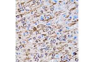 Immunohistochemistry of paraffin-embedded rat brain using MLC3A antibody (ABIN6134219, ABIN6143466, ABIN6143468 and ABIN6215215) at dilution of 1:100 (40x lens). (MAP1LC3A antibody  (AA 1-100))
