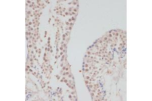 Immunohistochemistry of paraffin-embedded mouse testis using Cyclin G1 antibody (ABIN6127734, ABIN6138095, ABIN6138096 and ABIN6220906) at dilution of 1:100 (40x lens).