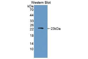 Figure. (DISC1 antibody  (AA 151-330))