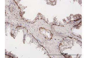 Immunoperoxidase of purified MaxPab antibody to KRT15 on formalin-fixed paraffin-embedded human prostate. (KRT15 antibody  (AA 1-456))