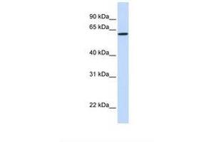 Image no. 1 for anti-DiGeorge Syndrome Chromosome Region-2 (DGS2) (AA 254-303) antibody (ABIN6738253) (DGCR2 antibody  (AA 254-303))