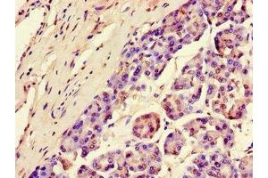 Immunohistochemistry (IHC) image for anti-serum/glucocorticoid Regulated Kinase 1 (SGK1) (AA 247-406) antibody (ABIN7169176)