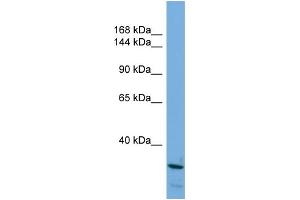 Host: Rabbit Target Name: ARID5B Sample Type: HepG2 Whole Cell lysates Antibody Dilution: 1. (ARID5B antibody  (N-Term))