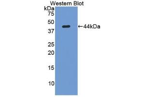 Detection of Recombinant LUM, Human using Polyclonal Antibody to Lumican (LUM) (LUM antibody  (AA 19-338))