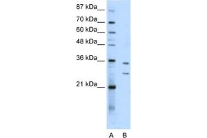 Western Blotting (WB) image for anti-Brix Domain Containing 5 (RPF1) antibody (ABIN2462306) (RPF1 antibody)