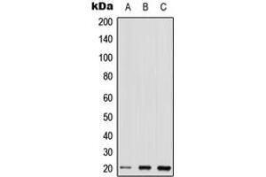 Western blot analysis of TC10 expression in HEK293T (A), Raw264. (RHOQ antibody  (Center))
