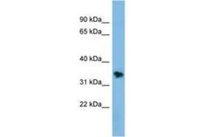 Image no. 1 for anti-Non-SMC Element 1 Homolog (NSMCE1) (AA 143-192) antibody (ABIN6744745) (NSMCE1 antibody  (AA 143-192))