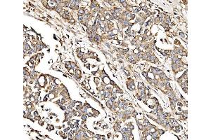 IHC analysis of MPPB/PMPCB using anti-MPPB/PMPCB antibody (ABIN7600758).