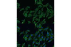 Immunofluorescence analysis of C6 cells using DDX3Y Polyclonal Antibody (ABIN6130260, ABIN6139496, ABIN6139497 and ABIN6215395) at dilution of 1:100 (40x lens). (DDX3Y antibody  (AA 1-210))