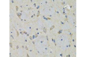 Immunohistochemistry of paraffin-embedded Rat brain using RAE1 Polyclonal Antibody at dilution of 1:100 (40x lens). (RAE1 antibody)