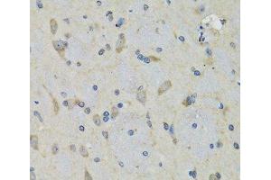 Immunohistochemistry of paraffin-embedded Rat brain using RAE1 Polyclonal Antibody at dilution of 1:100 (40x lens).
