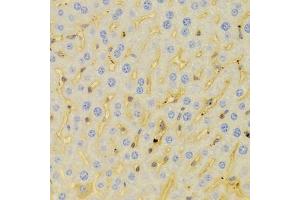 Immunohistochemistry of paraffin-embedded mouse liver using PCM1 Antibody (ABIN5973331) at dilution of 1/100 (40x lens). (PCM1 antibody)