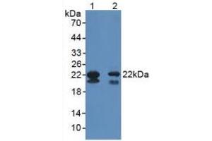 Western blot analysis of (1) Mouse Testis Tissue and (2) Mouse Heart Tissue. (GPX4 antibody  (AA 74-197))