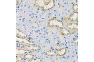 Immunohistochemistry of paraffin-embedded rat kidney using HS1BP3 antibody. (HS1BP3 antibody  (AA 1-200))