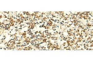 Immunohistochemistry of paraffin-embedded Human tonsil tissue using IFT27 Polyclonal Antibody at dilution of 1:50(x200) (RABL4 antibody)