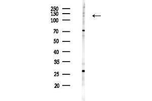 Western blot analysis of lysates from COLO205 cells(starvation 24h treatment), using Phospho-MYPT1 (Ser852) Antibody at 1/1000 dilution.