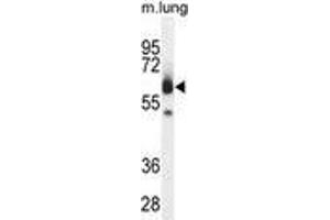 ZUFSP Antibody (N-term) western blot analysis in mouse lung tissue lysates (35 µg/lane). (ZUFSP antibody  (N-Term))