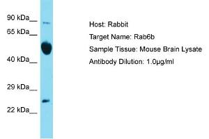 Host: Rabbit Target Name: Rab6b Sample Type: Mouse Brain lysates Antibody Dilution: 1. (RAB6B antibody  (C-Term))