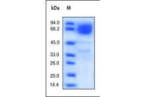 SDS-PAGE (SDS) image for CD36 (CD36) (AA 30-439) protein (His tag) (ABIN2180762)