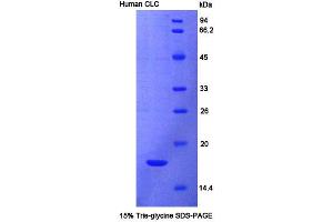 SDS-PAGE analysis of Human CLC Protein. (Galectin 10 Protein)