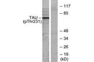 Western blot analysis of extracts from MDA-MB-435 cells, using Tau (Phospho-Thr231) Antibody. (tau antibody  (pThr548))