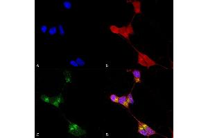 Immunocytochemistry/Immunofluorescence analysis using Mouse Anti-GABA-A Receptor Delta Monoclonal Antibody, Clone N151/3 (ABIN863138).