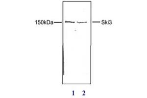 Western Blot results of anti-SKI3 antibody Western Blot results of Rabbit anti-SKI3 antibody. (TTC37 antibody)