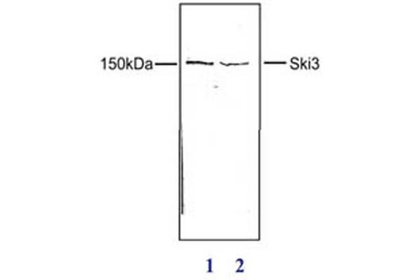 TTC37 antibody