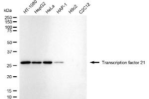 Western blotting analysis using Transcription factor 21 antibody (ABIN7800587).