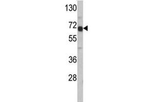 Western blot analysis of AFP antibody and HepG2 lysate. (alpha Fetoprotein antibody  (AA 56-85))