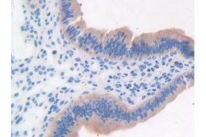 Immunohistochemistry (IHC) image for anti-Leucine-Rich alpha-2 Glycoprotein 1 (LRG1) (AA 136-342) antibody (ABIN7434374)