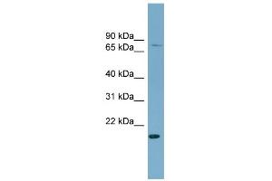 WB Suggested Anti-PDZRN4 Antibody Titration:  0. (PDZRN4 antibody  (N-Term))