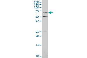 SLCO2A1 polyclonal antibody (A01), Lot # 060529JCS1 Western Blot analysis of SLCO2A1 expression in HL-60 . (SLCO2A1 antibody  (AA 276-325))