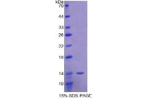 Image no. 1 for Sema Domain, Immunoglobulin Domain (Ig), Short Basic Domain, Secreted, (Semaphorin) 3E (SEMA3E) (AA 581-669) protein (His tag) (ABIN1080786) (SEMA3E Protein (AA 581-669) (His tag))