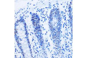 Immunohistochemistry of paraffin-embedded Human colon using Asymmetric DiMethyl-Histone H3-R8 Rabbit pAb (ABIN3017485, ABIN3017486, ABIN3017487 and ABIN6220109) at dilution of 1:100 (40x lens). (Histone 3 antibody  (H3R8me2))