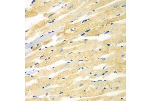 Immunohistochemistry of paraffin-embedded rat heart using PDE4DIP antibody at dilution of 1:100 (40x lens). (PDE4DIP antibody)